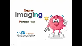 13 Brain imaging Posterior fossa  TEC  Prof  Mamdouh Mahfouz