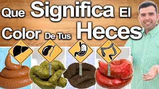 Qué Color Son Tus Heces? - Lo Que Tus Heces Revelan Sobre Tu Salud