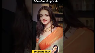 Sussanne khan (Ex wife of Hritik Roshan) Face evolution video#shorts #viral