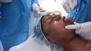 A very Difficult Anesthesia Intubation for a Hemangioma Patient