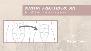 Unlock Healing: 6 Best Exercises for Diastasis Recti