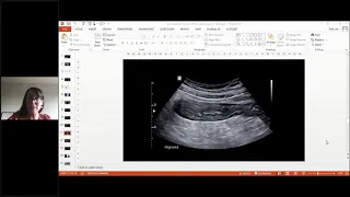 Ultrasound and Patient Triage