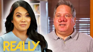 Dr. Lee Removes Huge Growths On A Man's Nose | Dr. Pimple Popper