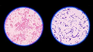 Staining technique in microbiology: Gram staining