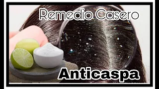 Remedio Casero Anticaspa// Todo Sobre La Caspa