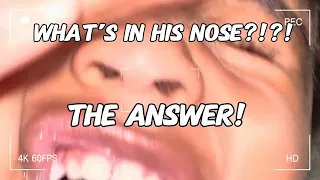 YOU CANT MAKE THIS STUFF UP PART 2- WHAT IS IN HIS NOSE?! THE REVEAL! PARENTS CHECK YOUR KID'S NOSE!