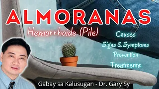 Hemorrhoids (Almoranas) - Dr. Gary Sy