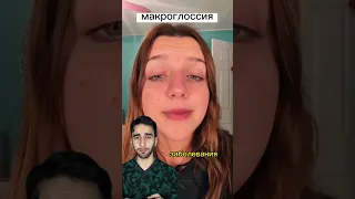 огромный язык что делать?