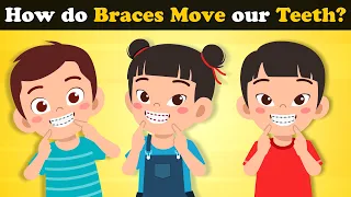 How do Braces Move our Teeth? + more videos | #aumsum #kids #science #education #whatif