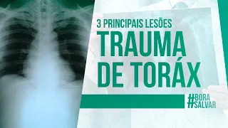 TRAUMA de TORÁX: Principais Lesões