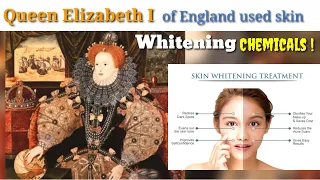Queen Elizabeth I of England Used Skin Whitening Chemicals !