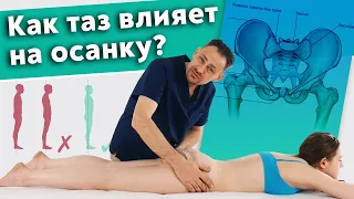 Как исправить осанку? / Перекос таза, как причина нарушения осанки!