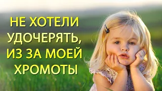 Меня не хотели удочерять, из за моей хромоты. Одна нога была короче другой