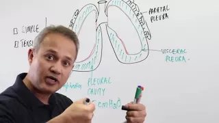 Pneumothorax