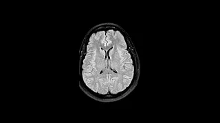 First Look MRI Sample Videos