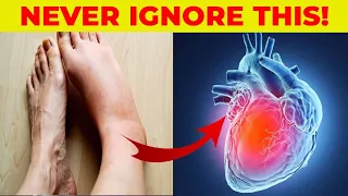 5 Signs Of A Heart Attack You Should Never Ignore | Heart Failure | Irregular Heart beat|Silva Guide