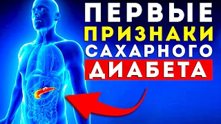 Вот Оказывается Какие ► Первые Признаки и Симптомы Сахарного Диабета