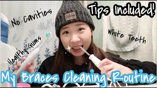 MY BRACES CLEANING ROUTINE**TIPS INCLUDED**⎥No Cavities, Healthy Gums, White Teeth