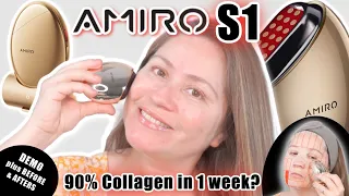AMIRO S1 Facial RF Skin Tightening Device | DEMO W/ BEFORE & AFTER RESULTS