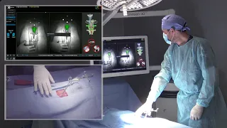 7D Surgical System – Spinal Workflow Demonstration