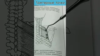 БОЛЬ В ЛОПАТКЕ, БОЛЬ МЕЖДУ ЛОПАТОК ТРИГГЕРНЫЕ ТОЧКИ