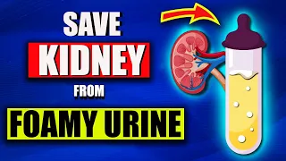 Top 17 SuperFoods to stop Proteinuria quickly and Heal Kidney Fast (Not What You Think)