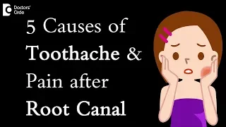 5 Causes of toothache and pain after root canal - Dr. Manesh Chandra Sharma