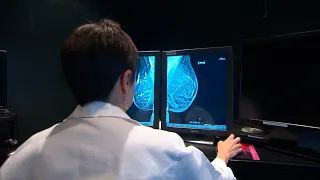 Mammograms should start at age 40, new guidelines recommend