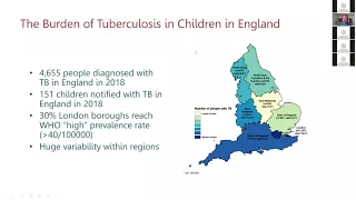 Tuberculosis in children: Dr James Seddon | PaeCH Teaching for Trainees