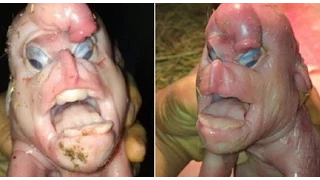 Pig Born With Human Face AND PenIS ON It's Forehead [SHOCKING]