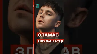 💥 Пивоваров під час концерту зламав ніс фанатці #еспресо #новини