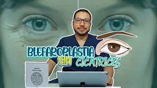 ¿Qué es la Blefaroplastia transconjuntival? - Dr. Andrés Callejas