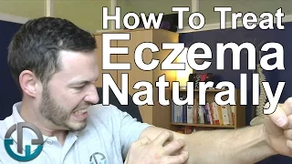 How To Treat Eczema Naturally