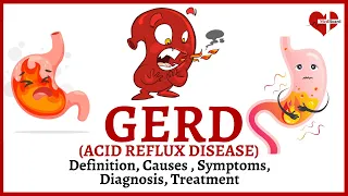 What is GERD (Acid Reflex) | Easy Overview of GERD (Acid reflux Disease)