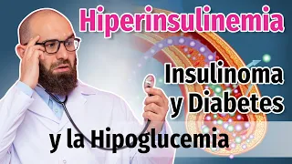 Hiperinsulinismo, insulinoma e hipoglucemias / Cap. 38 y 39 - Dr. Mario Vega Carbó.