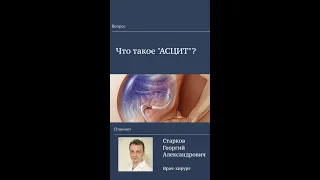 Асцит? Что это!?