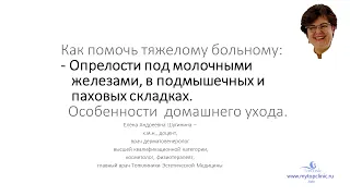 Опрелости под молочными железами и в паховой области