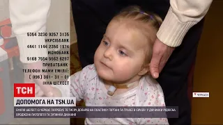 Допомога ТСН: родина з Черкас збирає кошти на порятунок доньки, в якої деформована трахея