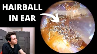 Painful Hairball Stuck In Ear Canal