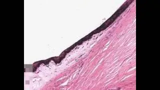 Shotgun Histology Eye