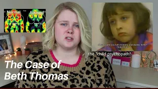 THE MIRACULOUS RECOVERY OF BETH THOMAS | THE "CHILD PSYCHOPATH" | CHILD OF RAGE CASE