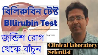 বিলিরুবিন টেস্ট  Bilirubin Test (Blood Test) জন্ডিশ পরীক্ষা,Jundice Test