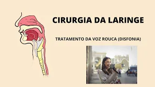 Cirurgia da Laringe - Tratamento da Voz Rouca (Disfonia).