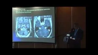 Радиохирургия в лечении головного и спинного мозга