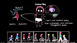 Managing cerebral palsy | Mental health | NCLEX-RN | Khan Academy