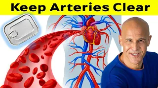 Keep Arteries Clean...Prevent Against Heart Attack & Stroke | Dr Alan Mandell, DC