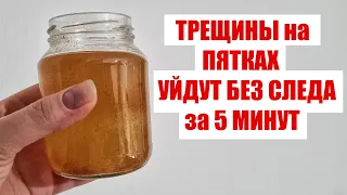 От ТРЕЩИН НА ПЯТКАХ и следа не останется. 5 Минут и Трещины на пятках исчезнут навсегда