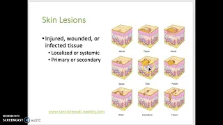 Chapter 5 Integumentary System Lecture