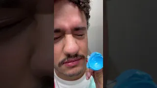 Removing The EyePrint Impression From An Eye With Keratoconus