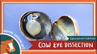 Eye Dissection || The Eyes Have It [EDU]